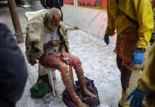 Auxilian a hombre con quemaduras en la Zona Centro